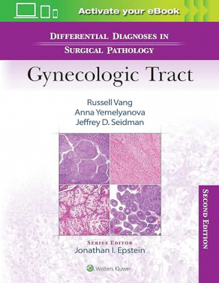 Differential Diagnoses in Surgical Pathology: Gynecologic Tract Second edition