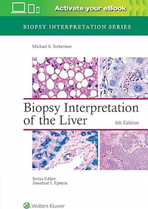 Biopsy Interpretation of the Liver Fourth edition