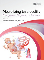 Necrotizing Enterocolitis