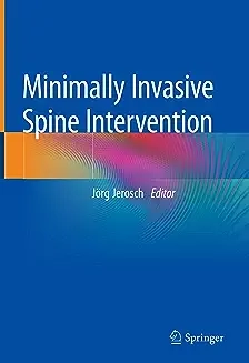 Minimally Invasive Spine Intervention